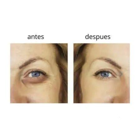 HUDABEAUTY Paakių kremas su alijošiumi, rutulinis – tamsių ratilų ir maišelių po akimis naikinimui(20ml.) - veidui - Damų Kampelis