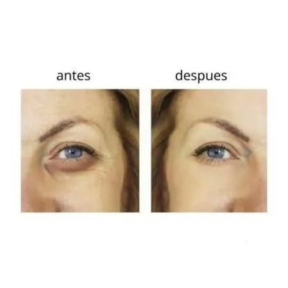 HUDABEAUTY Paakių kremas su alijošiumi, rutulinis – tamsių ratilų ir maišelių po akimis naikinimui(20ml.) - veidui - Damų Kampelis