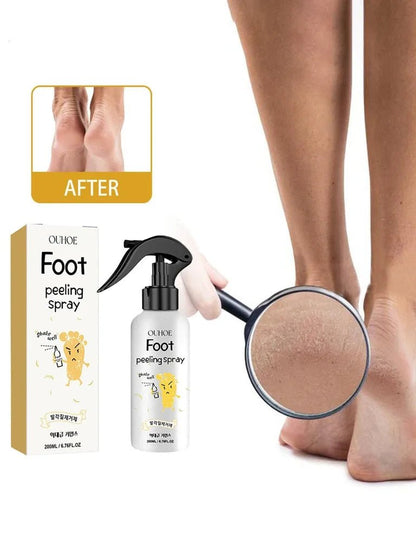 Pėdų šveitimo purškalas OUHOE Foot Peeling Spray, 200 ml-kūnui-Damų Kampelis