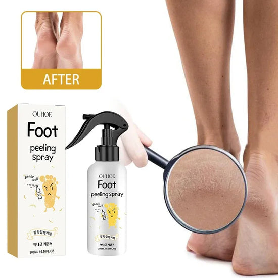 Foot-peeling-spray-intro